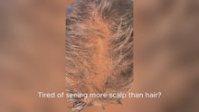 Load and play video in Gallery viewer, Cover and Grow Scalp Renewal Duo
